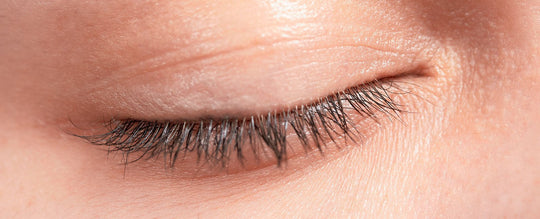 treating eyelid dermatitis